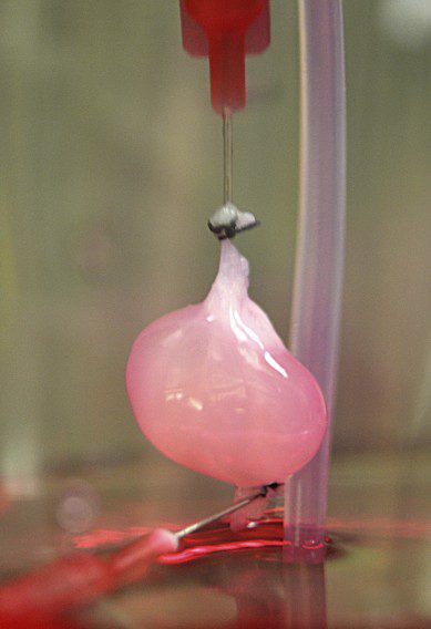 Lab Grown Kidney 