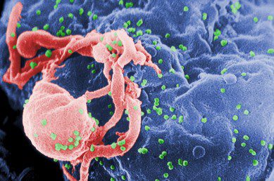 AIDS Virus 